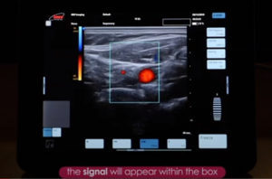 豚用超音波画像診断器妊娠診断